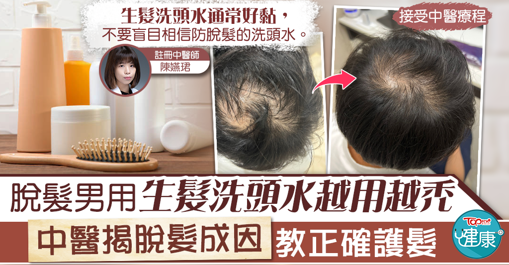 脫髮與洗髮習慣:中醫分享護髮要點