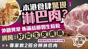 【偏頭痛】8個港人有1人患偏頭痛 OL受折磨逾10年:像有把刀由額頭割落頸