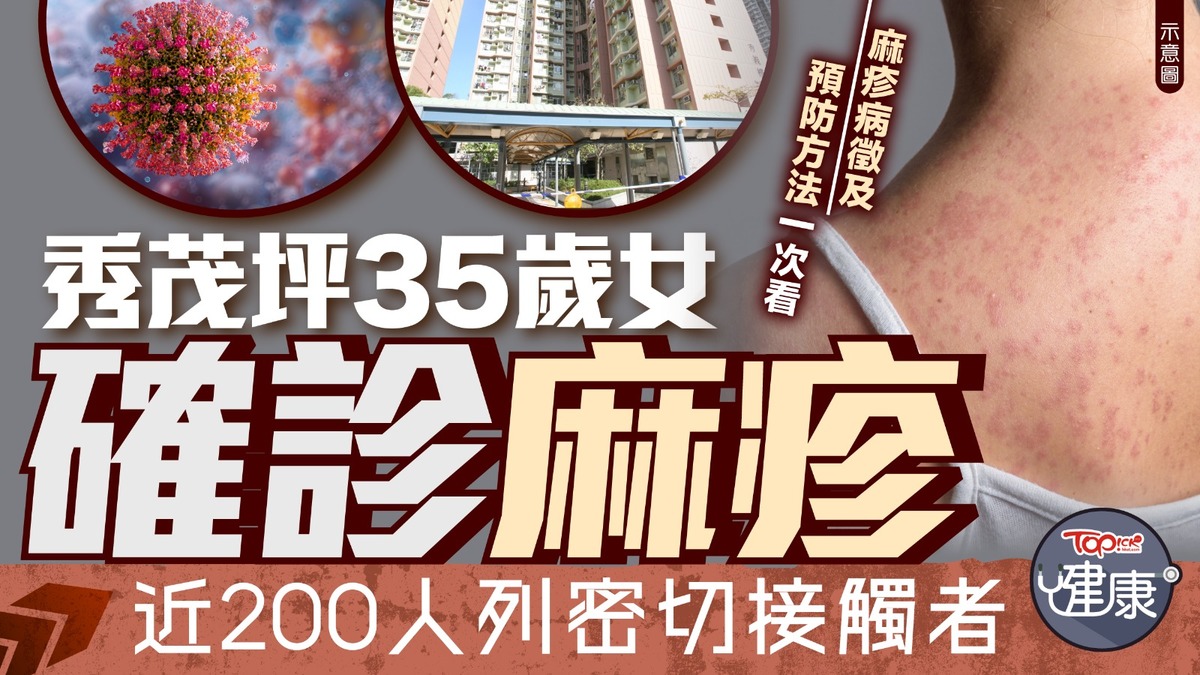 麻疹
